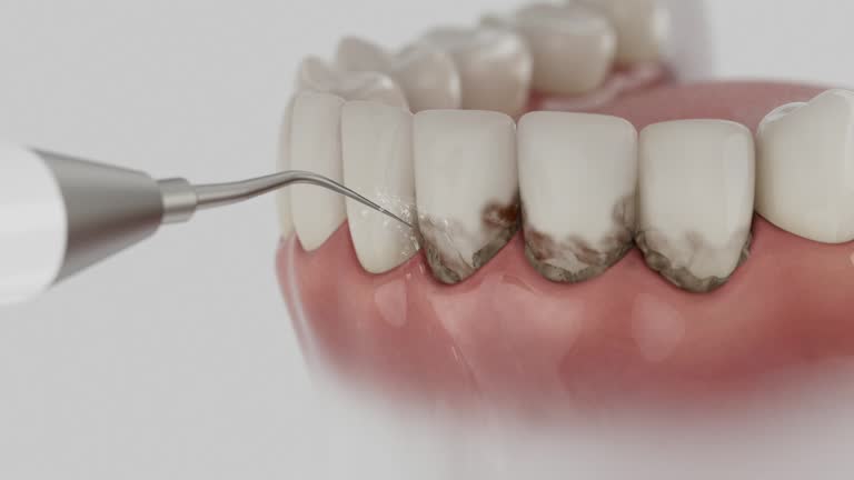 Trusted Wisdom Tooth Removal service in Williston, SC - Dentist Open Now